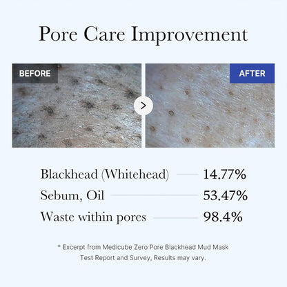 Pore & Glow K-Viral Mask Set: Turmeric Overnight Wrapping Peel off Mask and Collagen Overnight Wrapping Peel off Facial Mask Pack and Zero Pore Blackhead Mud Facial Mask and Jelly Brush 1